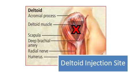 Injecting steroids into buttocks