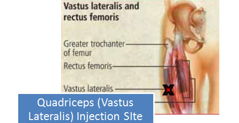 Where to inject steroids into shoulder