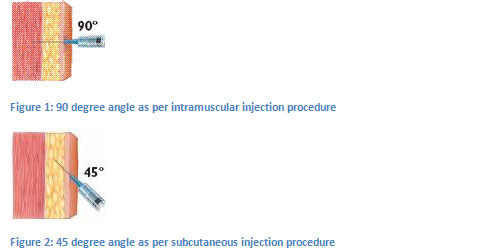 Testosterone propionate and proviron cycle