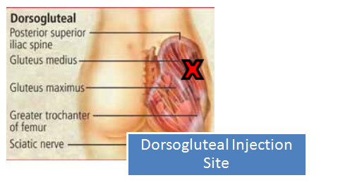 Test steroid types