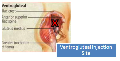 Anabolic steroid cycles