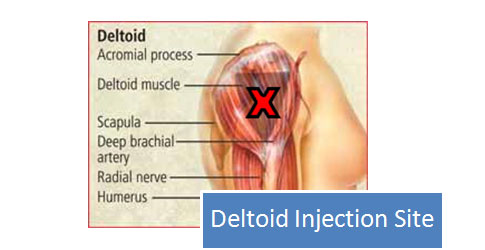 Steroid profiles trenbolone